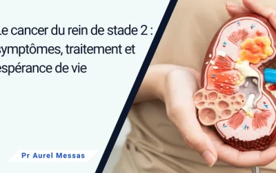 Le cancer du rein stade 2, symptômes, diagnostic et traitements