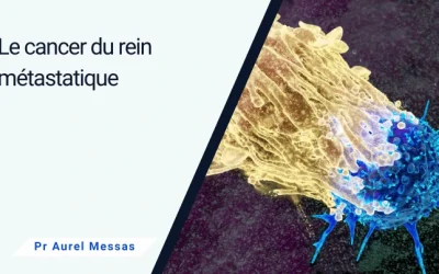 Le cancer du rein métastatique